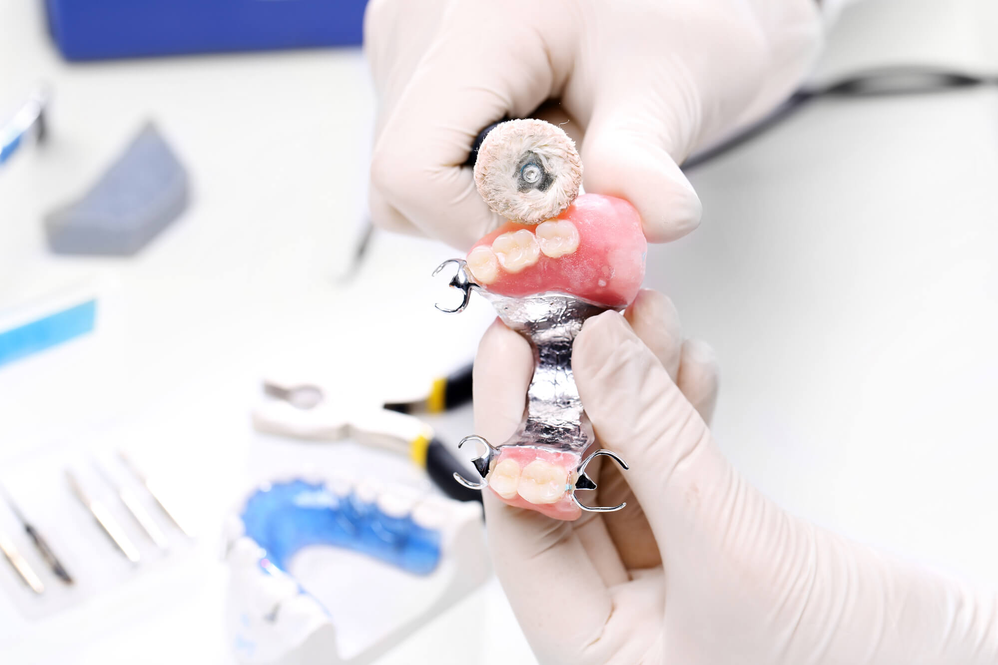 Dental Implants Vs. Dentures: Which Is Better