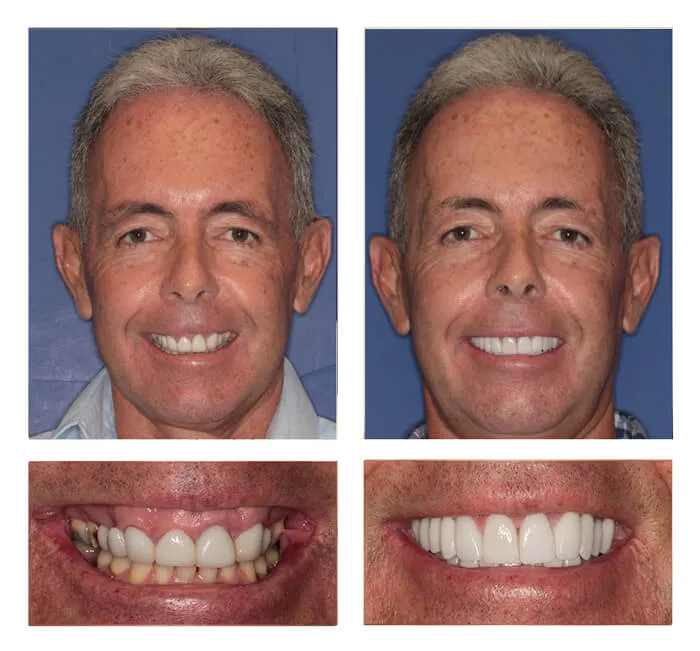 Candidacy for Sedation Dentistry