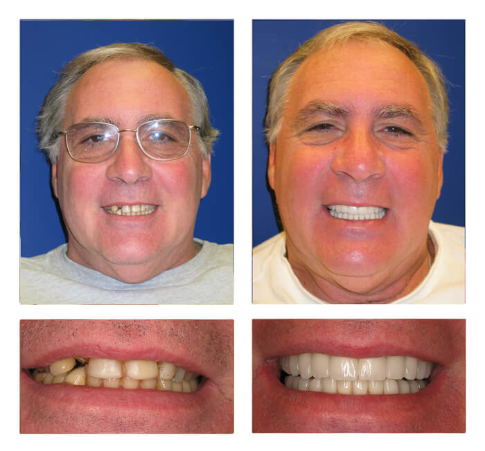 patient's smile transformation