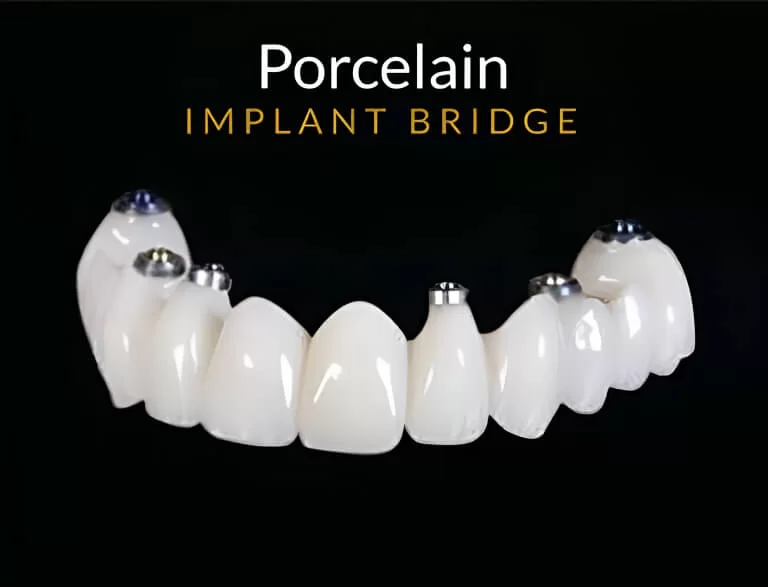 porcelain