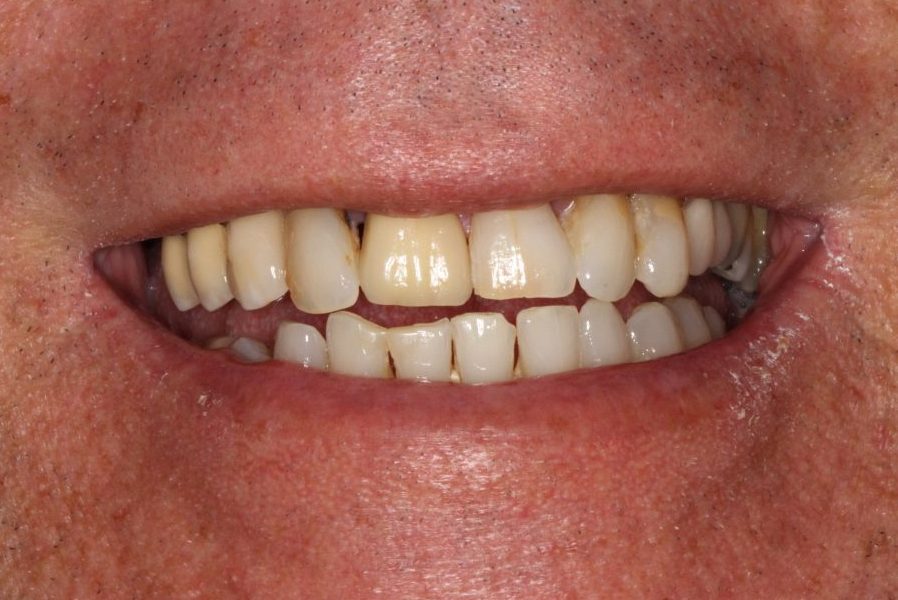 Before image