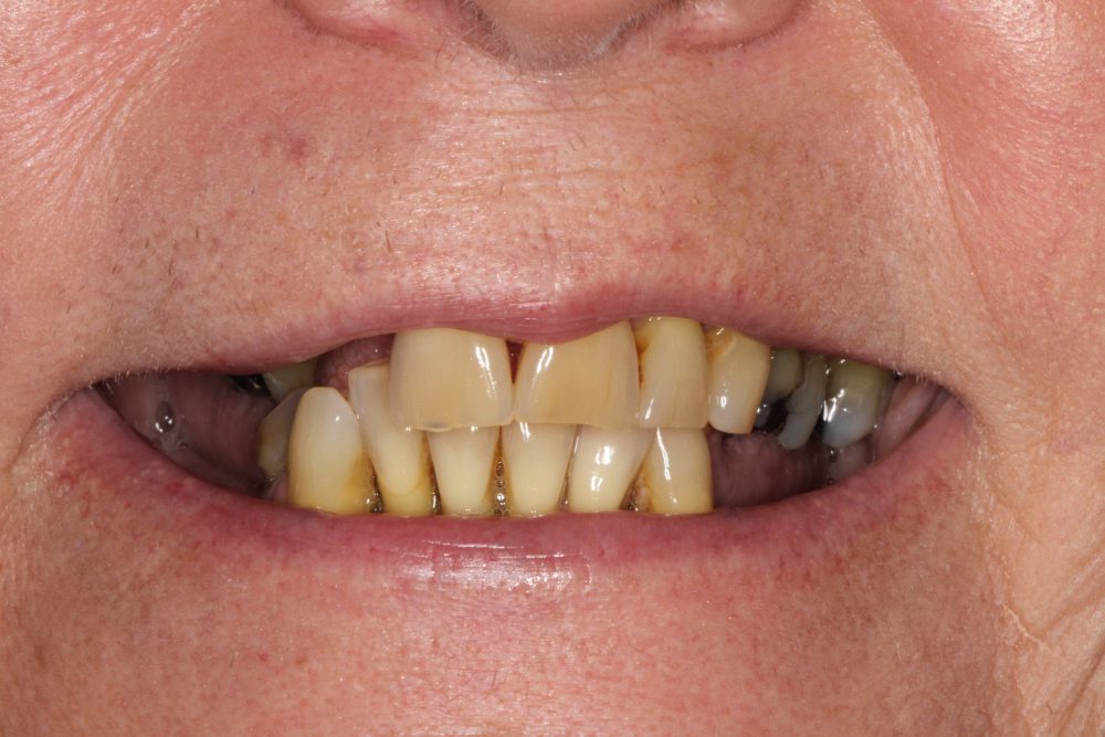 Before image