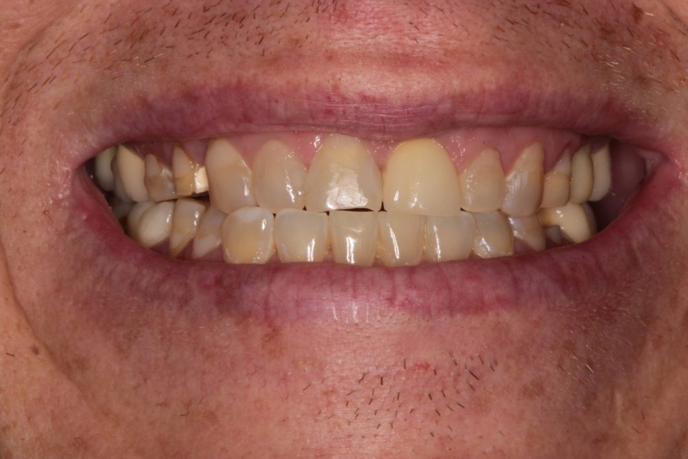 Before image